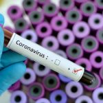 Vico Equense, giovane medico positivo al Coronavirus